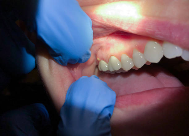 Best Emergency Broken Tooth Repair in Hardwick, GA