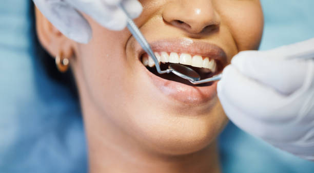 Best Emergency Wisdom Teeth Removal in Hardwick, GA